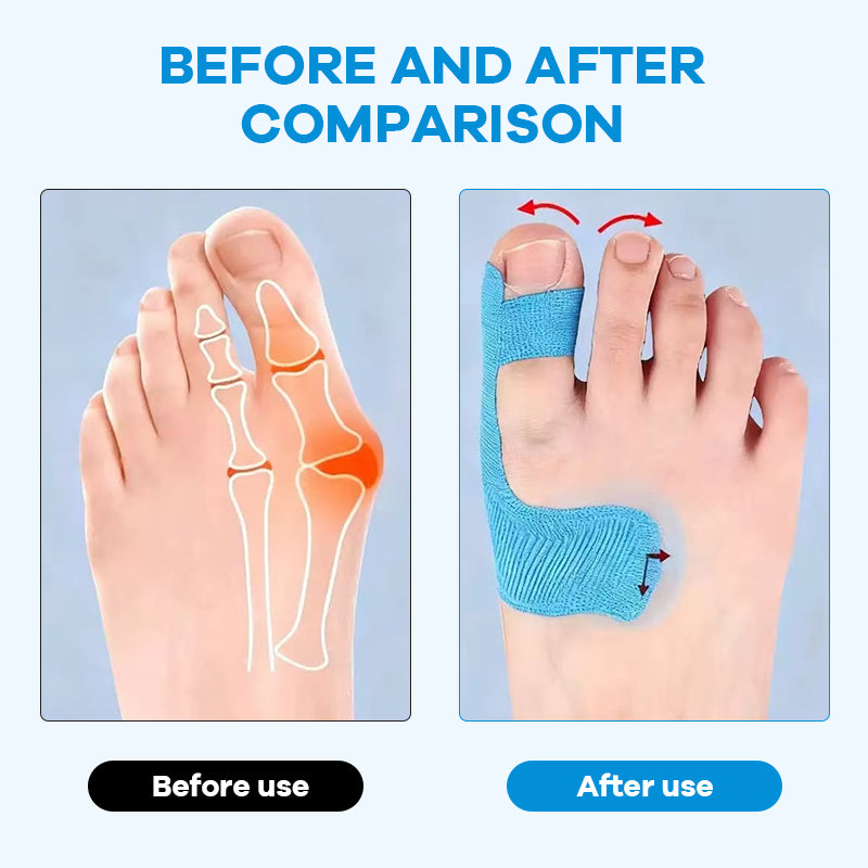 Pre-cut kinesiology tape for hallux valgu