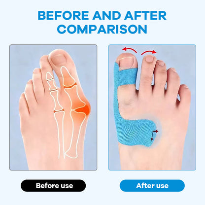 Pre-cut kinesiology tape for hallux valgu